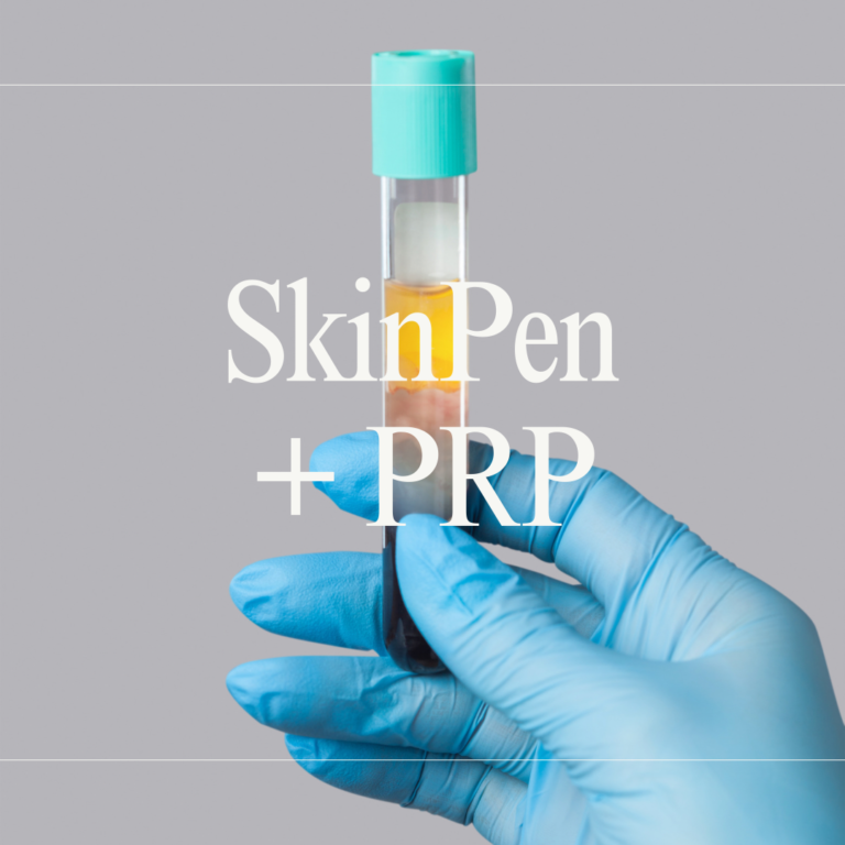 Skin Pen + PRP