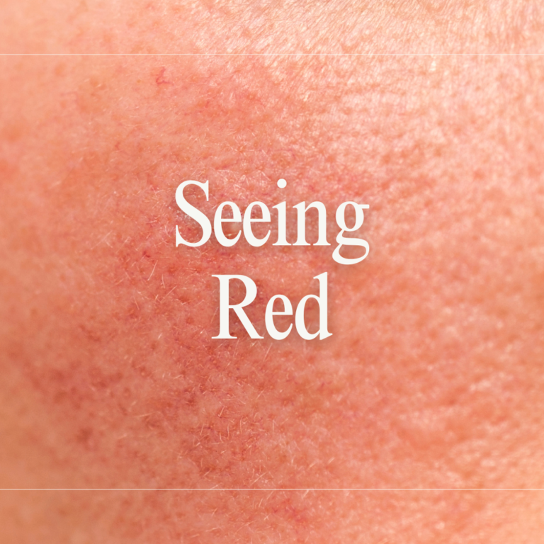 Seeing Red