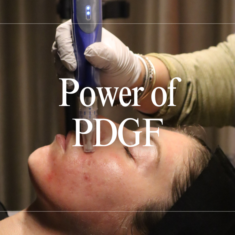 The Power of PDGF
